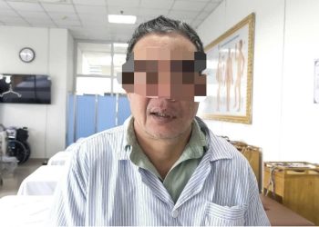 Đang khỏe mạnh, bỗng méo miệng vì lạnh