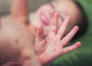 TP.HCM cảnh báo dịch tay chân miệng sau 3 trẻ tử vong