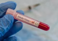 Bộ Y tế yêu cầu các cơ sở khám, chữa bệnh chủ động phòng chống dịch bệnh Ebola